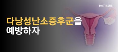 이달의핫이슈